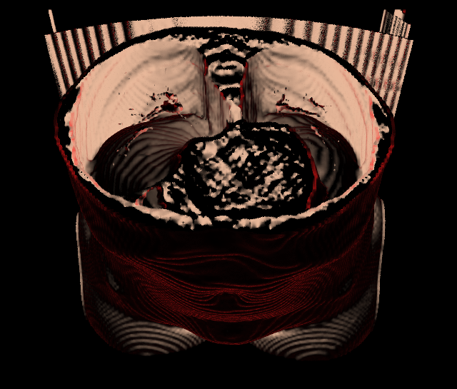 Torso CT, body surface